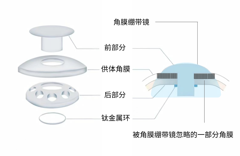 角膜绷带镜.png